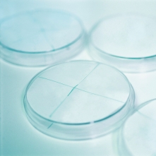 Application of Abakus® mobil fluid particle counter